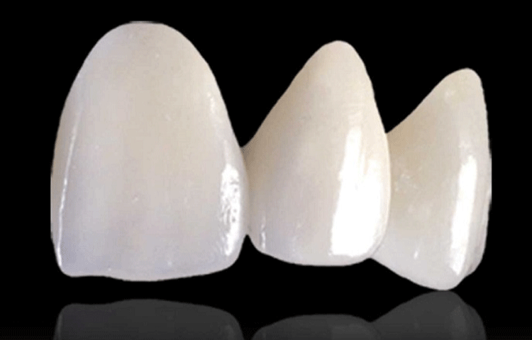 歯をきれいにすることで、あなたはもっときれいになれる