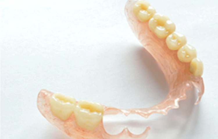 ノンクラスプデンチャー