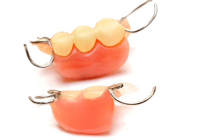 一般的な保険の入れ歯